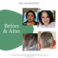 Anti-Hair Loss Shampoo