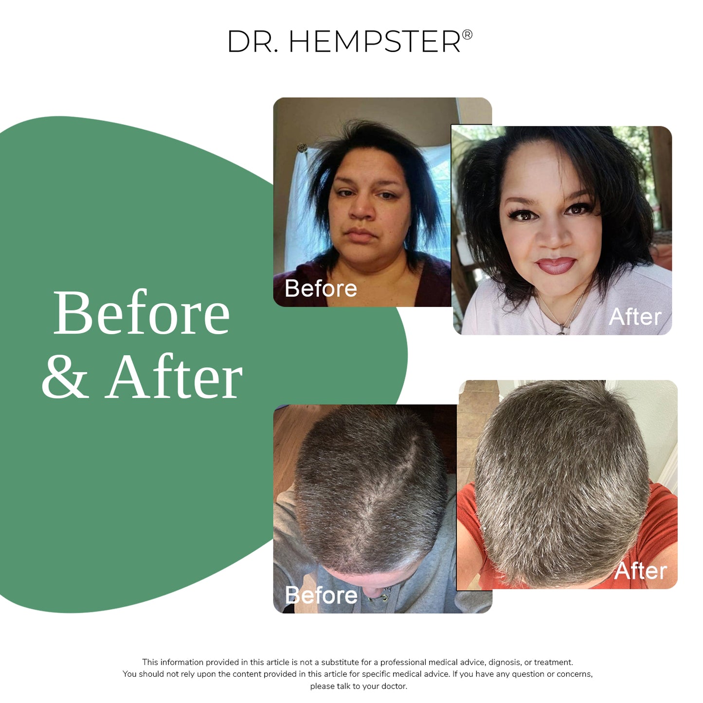 Anti-Hair Loss Shampoo